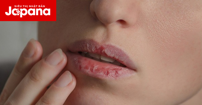 Những dấu hiệu cảnh báo bạn đang thiếu vitamin nghiêm trọng