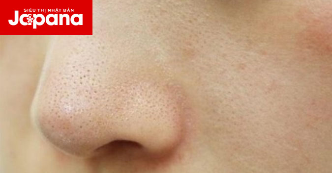 Làm sao để cải thiện tình trạng thâm ở hai bên cánh mũi ở tuổi 30?