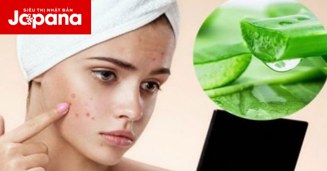 Làm dịu da mụn cho tuổi 30 với những công thức mặt nạ từ thiên nhiên