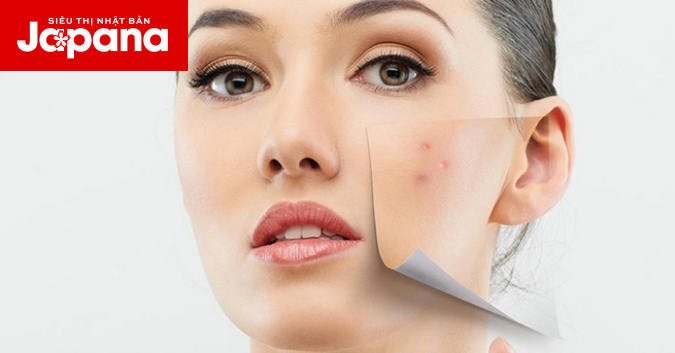 Mụn có khả năng hủy hoại da mặt không?