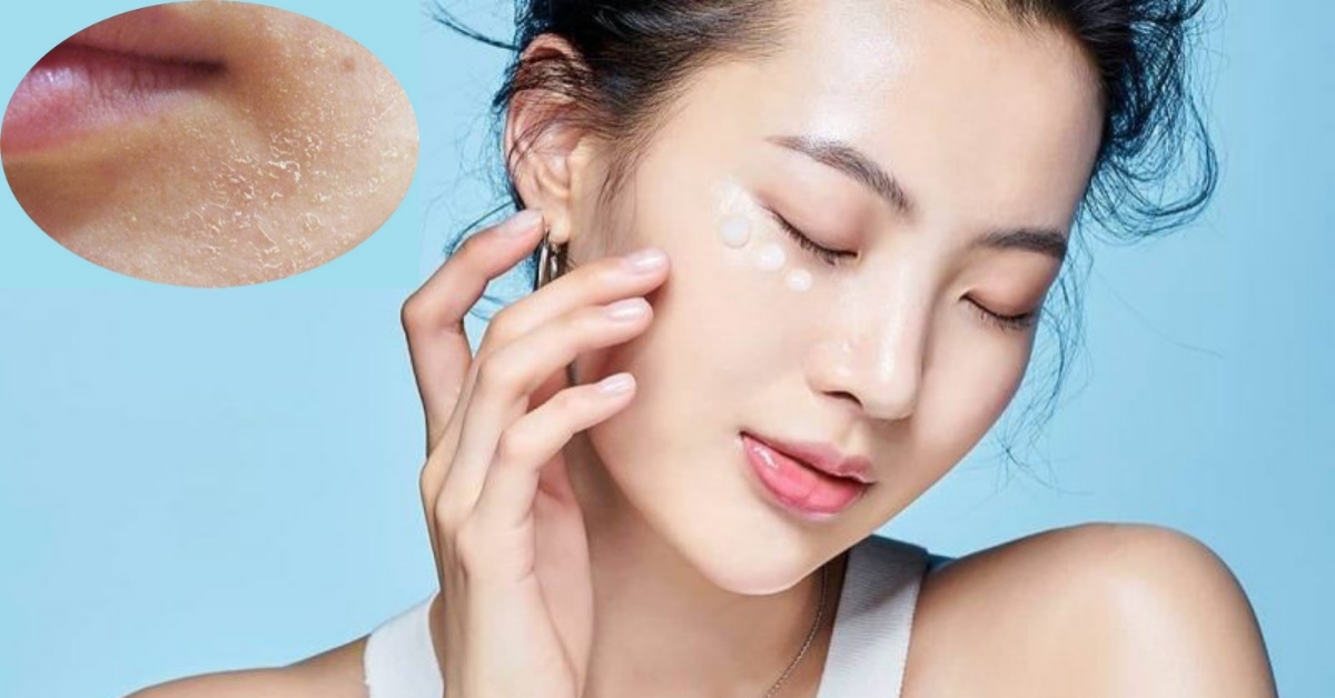 Da khô mùa đông nên làm gì để luôn mềm mịn, trắng hồng?