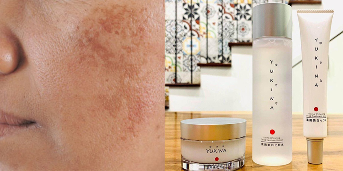 Bộ trị nám tàn nhang, dưỡng trắng da Yukina Medicated Skincare