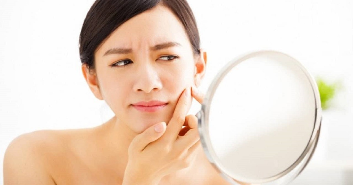Top 4 kem trị mụn dưỡng trắng da của nhật tốt nhất 2022