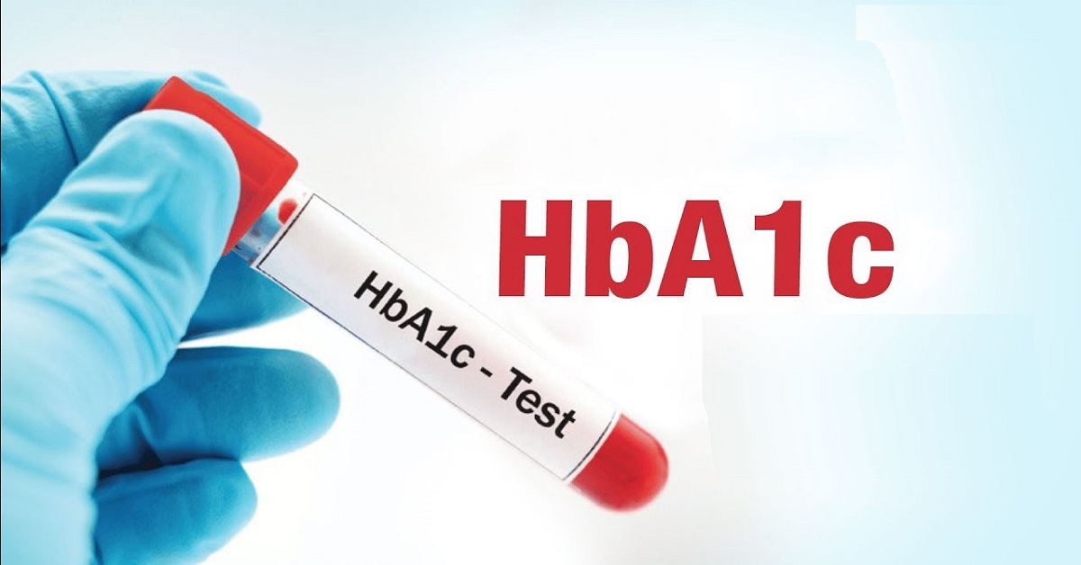 Chỉ số HbA1c bao nhiêu là bị tiểu đường? Cách đọc chỉ số HbA1c