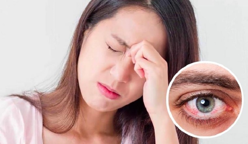 Bị đau mắt đỏ cần ăn uống gì và kiêng gì? 