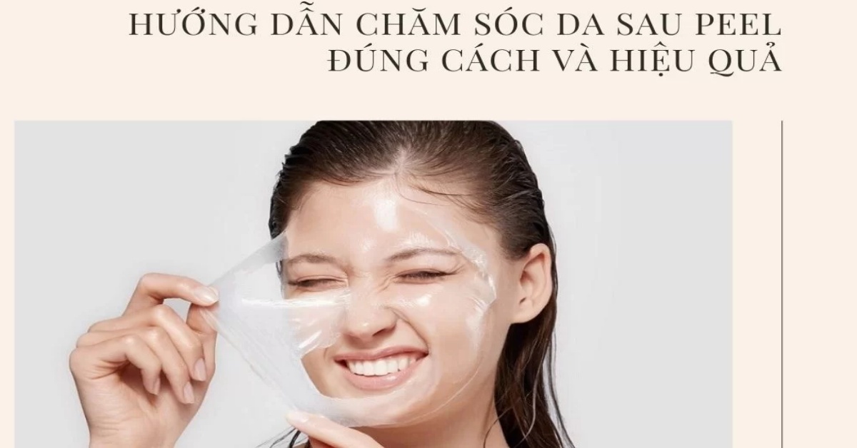 Cách chăm sóc da sau peel chuẩn y khoa đẹp không tì vết