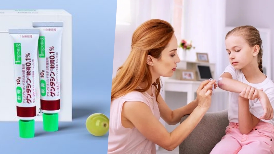 Kem trị sẹo Nhật có dùng cho trẻ em được không?