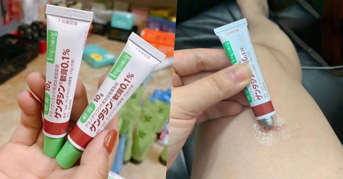 Review Kem trị sẹo Gentacin có tốt không?
