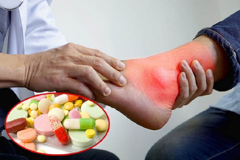 Cách nhận biết viên uống Gút Nhật Bản chính hãng đơn giản và chính xác