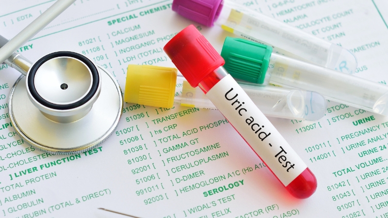 Chỉ số Acid Uric bao nhiêu thì bị Gout?