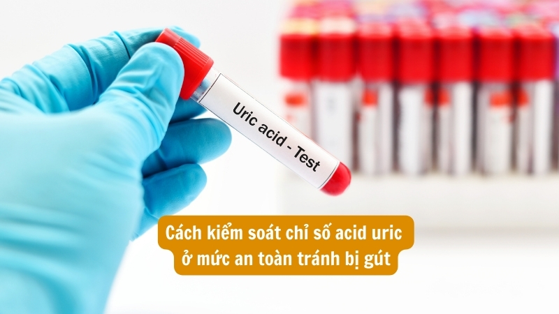 Cách kiểm soát chỉ số Acid Uric ở mức an toàn tránh bị Gút