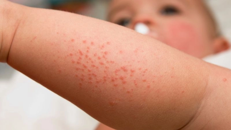 Mát gan cho trẻ em - Dấu hiệu nhận biết gan của trẻ không khỏe