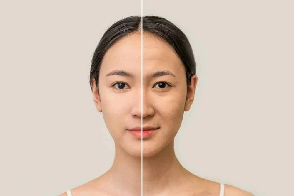 Lão Hóa Da Là Gì? 5 Cách Ngăn Ngừa Da Lão Hóa Sớm