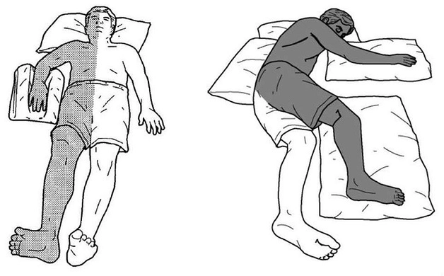 Đột Quỵ Liệt Nửa Người Có Hồi Phục Được Không ?