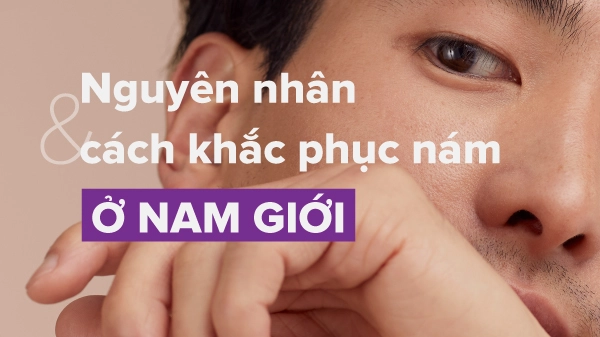 Nám Da Mặt Ở Nam Giới: Phân Biệt Nám Da Do Rối Loạn Nội Tiết Và Nám Da Thông Thường