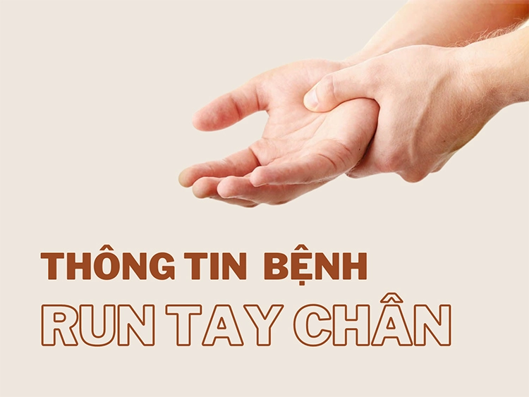 Run chân tay sau tai biến: Giải pháp phục hồi và chăm sóc sức khỏe hiệu quả