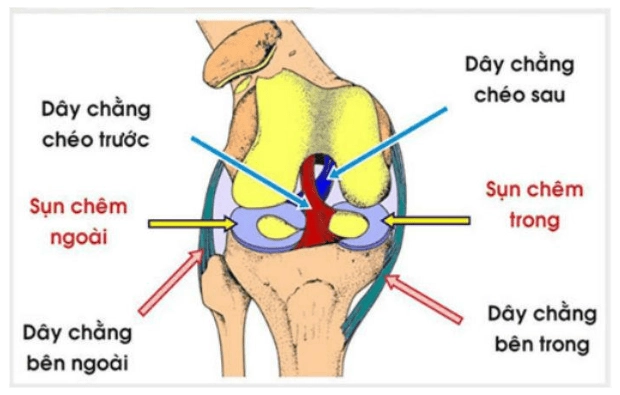 Nguyên Nhân, Dấu Hiệu và Cách Điều Trị Khi Bị Đứt Dây Chằng